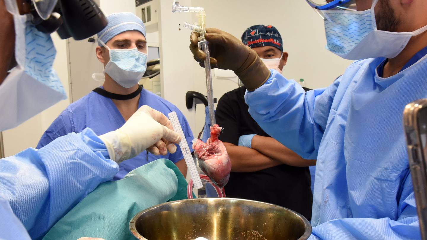 Surgeons in Maryland transplant pig heart for second time into dying man