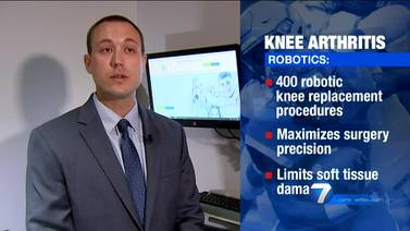Orthopedic Institute of Dayton Extra point: Week 11- Knee Arthritis and robotic knee replacements