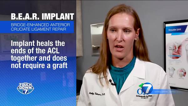 Week 5: OID Extra Point The Sports Health Minute- B.E.A.R. Implant